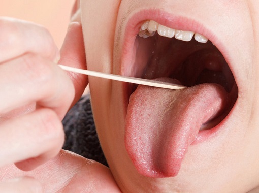 Народні методи лікування болю в горлі: перевірений досвід